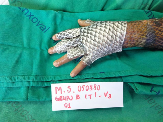 Tedavi olmaya gitti! Kolunu bu halde görünce... - Resim: 1