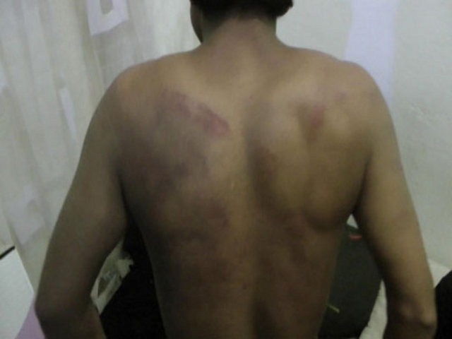 Polisi şoke eden işkence görüntüleri! - Resim: 3