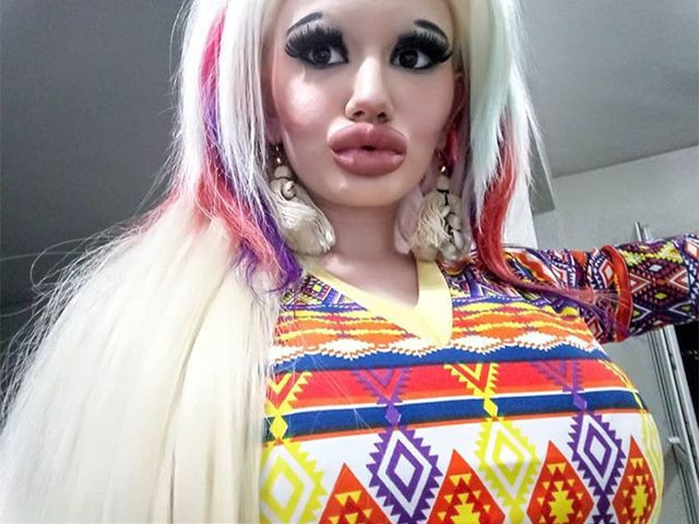 15 ameliyat geçirdi dudakları öyle bir hale geldi ki evlilik teklifi yağıyor - Resim: 2