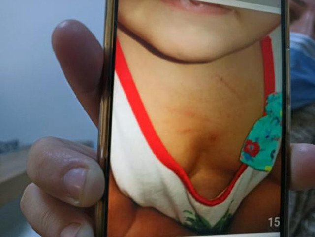 Mersin'de feci olay! Kreşteki şiddeti oyuncağın içine yerleştirilen ses kayıt cihazı ortaya çıkardı - Resim: 1