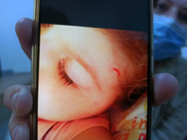 Mersin'de feci olay! Kreşteki şiddeti oyuncağın içine yerleştirilen ses kayıt cihazı ortaya çıkardı - Resim: 2