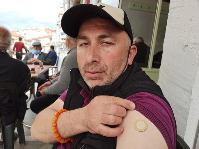 Afyonkarahisar'da vatandaşın iddiası: Covid-19 aşısından sonra koluna 1 lira yapıştı - Resim: 0