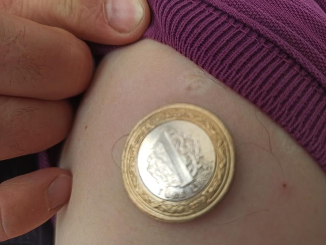 Afyonkarahisar'da vatandaşın iddiası: Covid-19 aşısından sonra koluna 1 lira yapıştı - Resim: 1