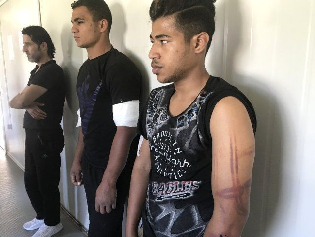 Plastik mermi elektrikli şok cihazları.... Dövüp Meriç Nehri'ne attılar! - Resim: 1