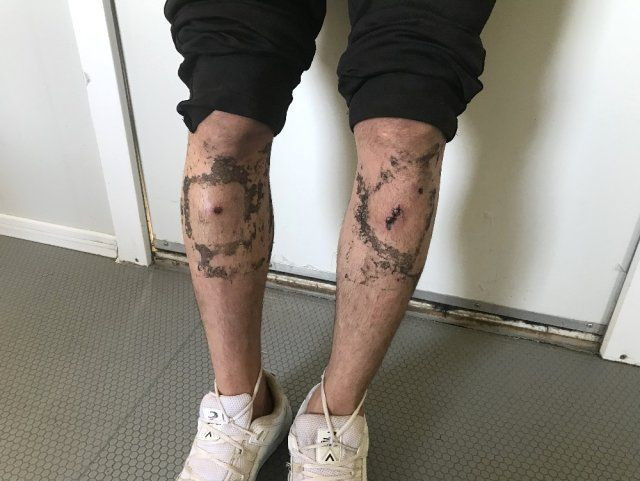 Plastik mermi elektrikli şok cihazları.... Dövüp Meriç Nehri'ne attılar! - Resim: 2