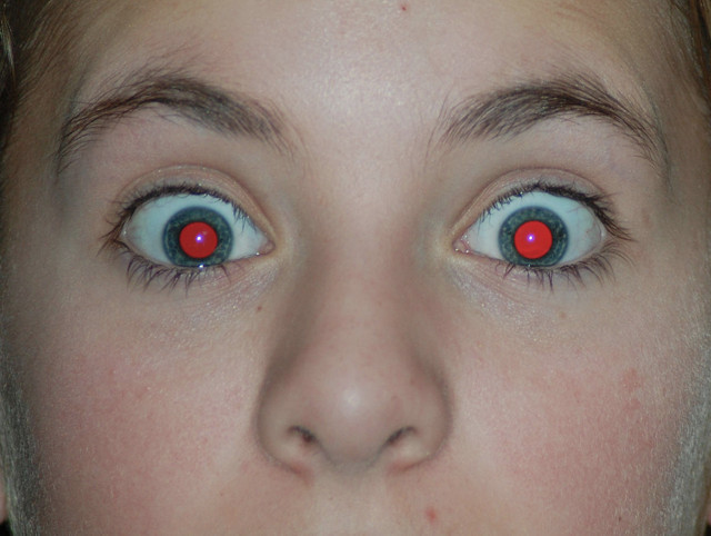Fotoğraflarda gözünüz kırmızı çıkıyorsa hemen doktora gidin sorun var! - Resim: 1