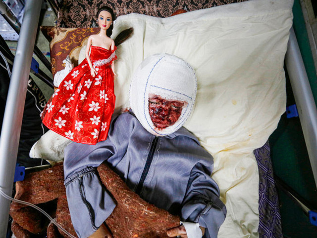 Yanıkların acısıyla kıvranan küçük çocuğun çığlıkları yürek burktu - Resim: 0