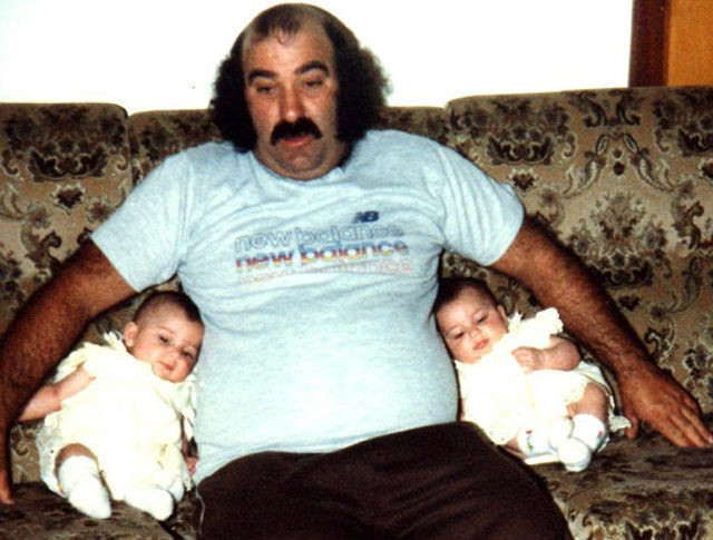 Estetik bağımlısı ikiz kardeşler - Resim: 1