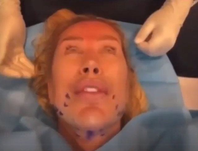 25 yaş küçük aşkı için yüzünü gerdiren Seda Sayan'ı gören tanıyamadı! Çağlar Ökten için bambaşka birine dönüştü - Resim: 4