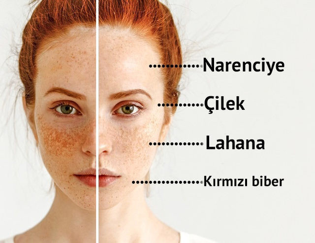 Akneli cilde sahip olanlar nasıl beslenmeli - Resim: 2