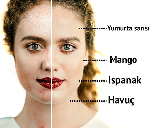 Akneli cilde sahip olanlar nasıl beslenmeli - Resim: 4