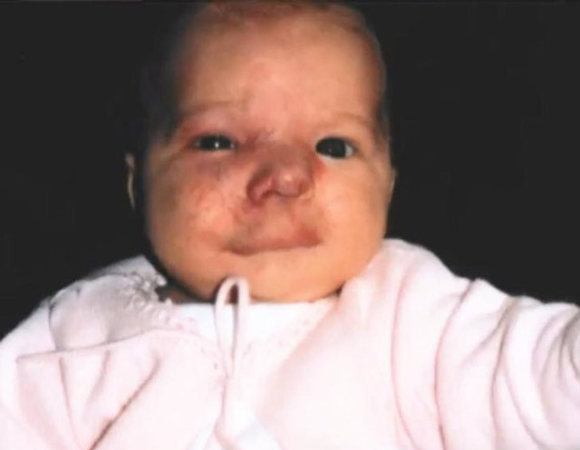 Küçük bir doğum lekesiyle doğdu 14 sene sonra bakın ne hale geldi! - Resim: 1