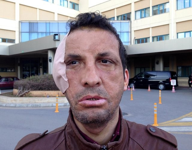 Yüzleri de hayatları da değişti - Resim: 1