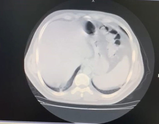 Koronavirüsün yenen doktor anlattı: Kafanızı suya sokup nefes almaya çalışmaya benziyor - Resim: 0