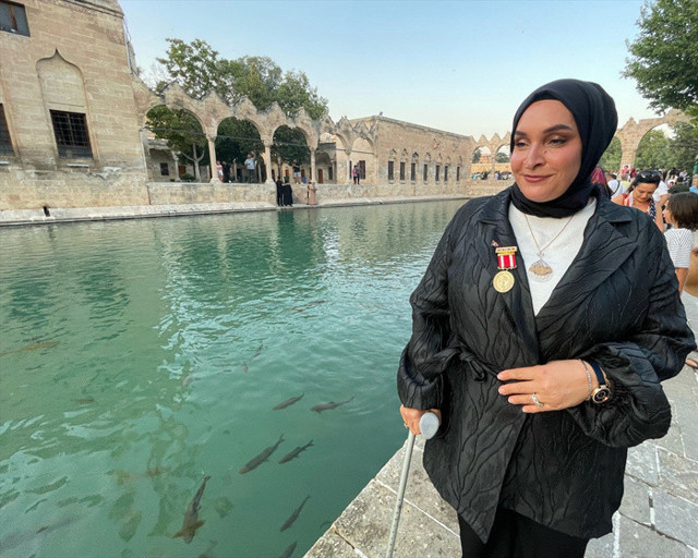 Tank üstlerinden geçti 9 yıl sonra yürümeye başladı - Resim: 0