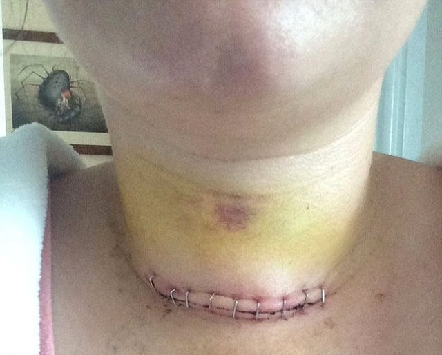 Kanser teşhisini markette koydular! - Resim: 2