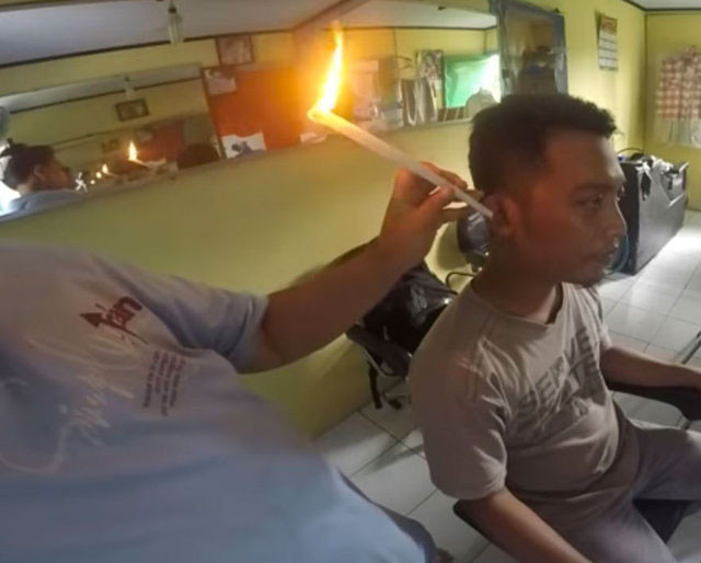 Yok böyle bir kulak temizliği şekli önce yakıyorlar sonra çekiyorlar - Resim: 2