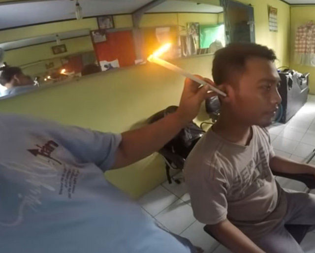 Yok böyle bir kulak temizliği şekli önce yakıyorlar sonra çekiyorlar - Resim: 3