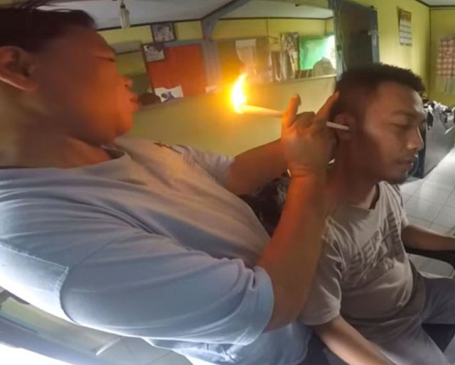 Yok böyle bir kulak temizliği şekli önce yakıyorlar sonra çekiyorlar - Resim: 4