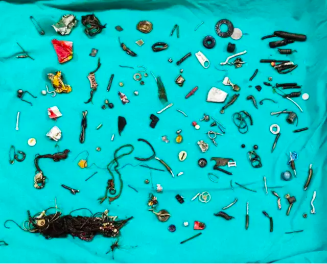 Midesinde çıkanlarla sergi açılır! Öyle şeyler çıktı ki Doktorlar bile şaştı kaldı - Resim: 0