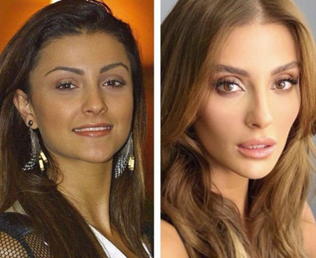 Estetiğim yok diyordu! Özge Ulusoy'un eski hali herkesi şoke etti! - Resim: 3