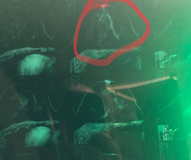 Fulden Uras'tan kötü haber! 'Benim için dua edin'  - Resim: 3