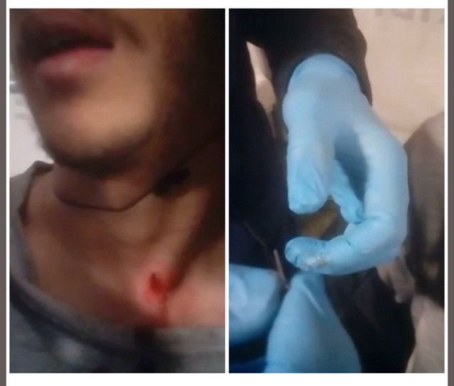 Yunanistan vahşetini bir tık öteye taşıdı! Sığınmacının boynundan çıkarıldı - Resim: 0