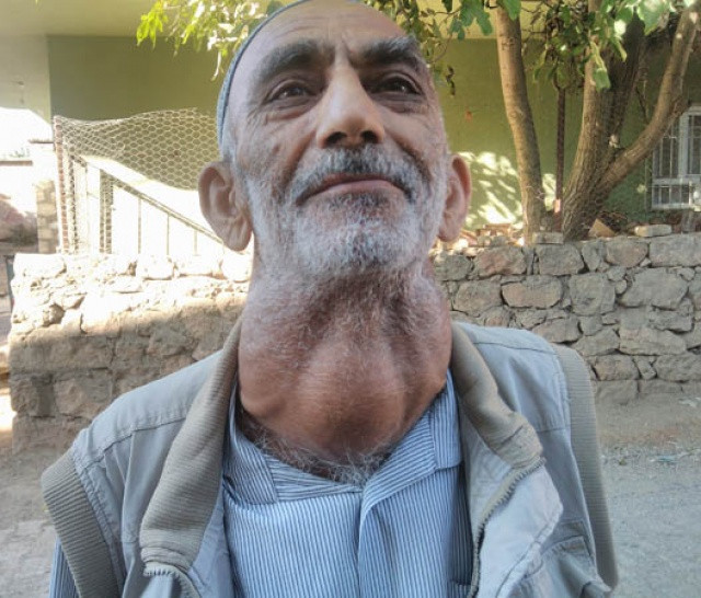 30 yıldır böyle yaşıyor! Kimse ikna edemedi.. - Resim: 1