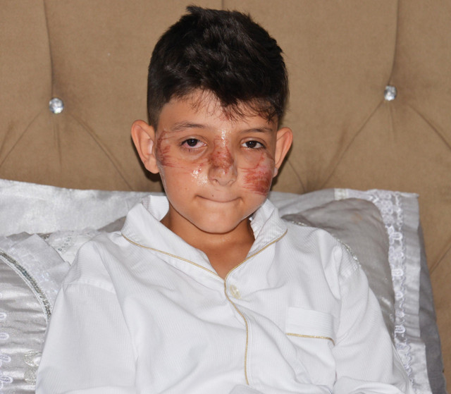 Sünnet günü az kalsın boynu kırılıyordu! Bahşiş için küçük çocuğu hastanelik ettiler - Resim: 0