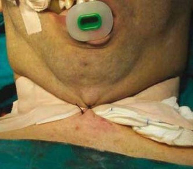 Trabzon çığır açtı! Bu yöntem dünyada ilk kez uygulandı! - Resim: 4