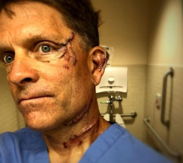 ABD'de mutfaktan gelen sese bakmaya gidince bu hale geldi - Resim: 0