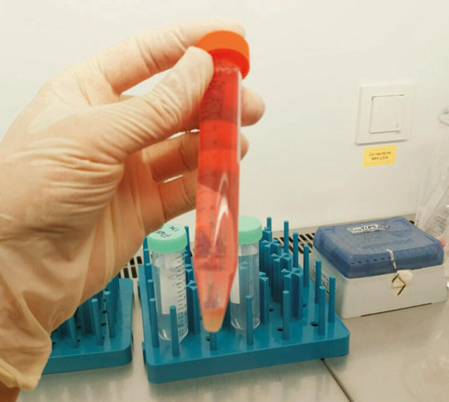 Bill Gates önermişti! Yapay ucuz et için formül Türkiye'den - Resim: 1