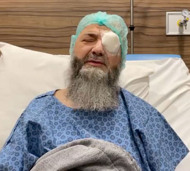 C&uuml;bbeli Ahmet Hoca ameliyat oldu hastalığı ne? 40 yıldır s&uuml;r&uuml;yor bacağı kesilen k&ouml;r olanlar oldu - Resim: 0
