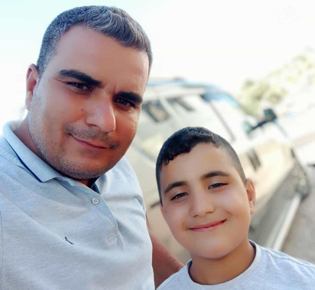 Elektrik çarpmasıyla komalık oldu! Bir yıl sonra aynı gün acı haber geldi - Resim: 0