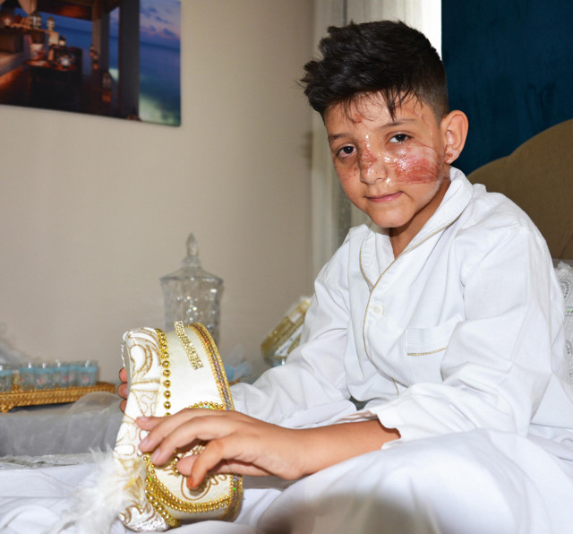 Sünnet günü az kalsın boynu kırılıyordu! Bahşiş için küçük çocuğu hastanelik ettiler - Resim: 1