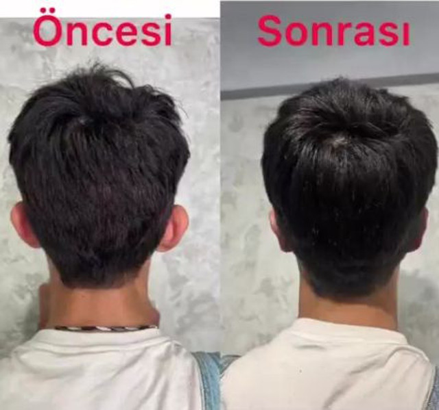 Taha Duymaz'dan çarpıcı itiraflar! Estetik pişmanlığı: Maruz kaldığı zorbalıkları tek tek anlattı! - Resim: 4