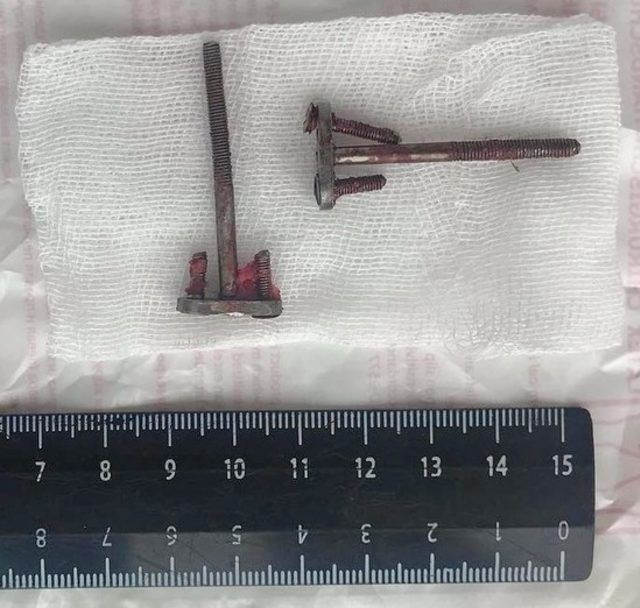 28 yıl sonra öğrendi! Görünce doktorlar bile şoke oldu - Resim: 3