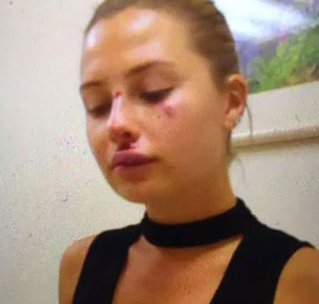 Serdar Ortaç'dan olay Chloe Loughnan açıklaması! Boşanıyorlar mı?  - Resim: 4