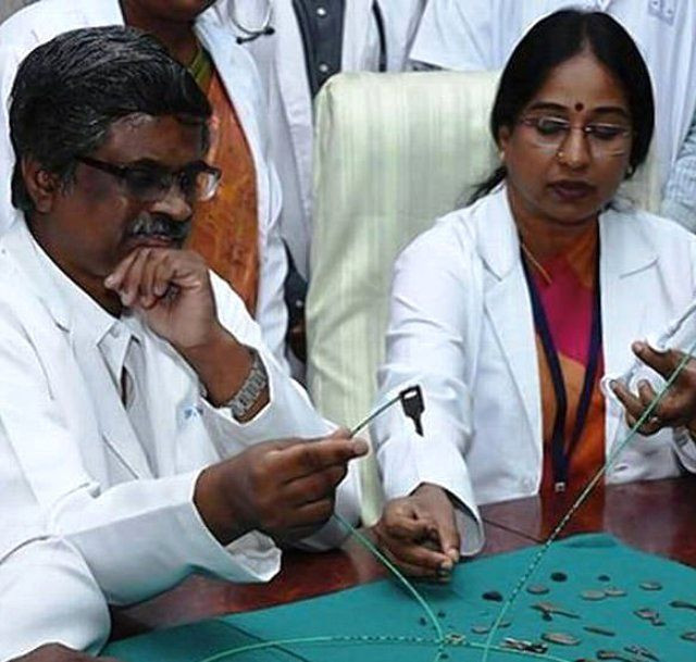 Doktorlar inanamadı midesinden tam 40 tane metal çıktı - Resim: 4