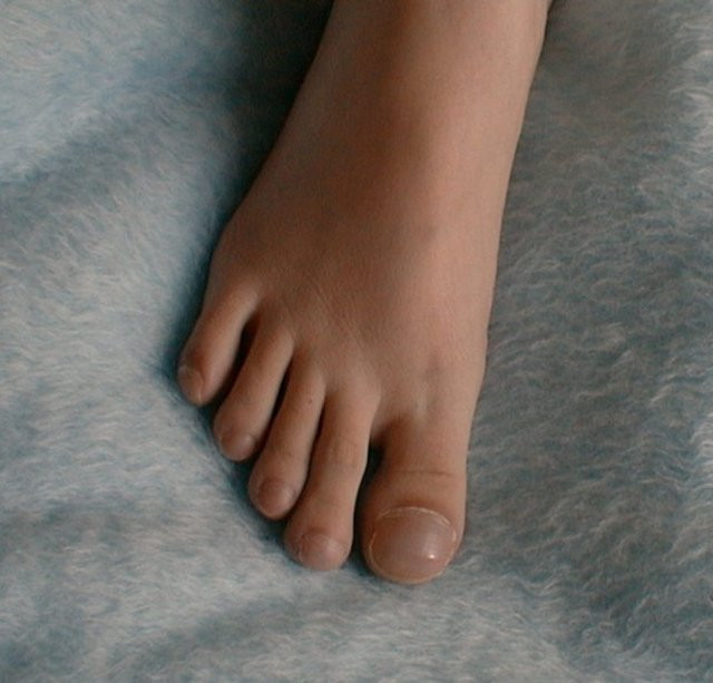 Ayağımızın bize anlatmak istediği 9 şey... - Resim: 2