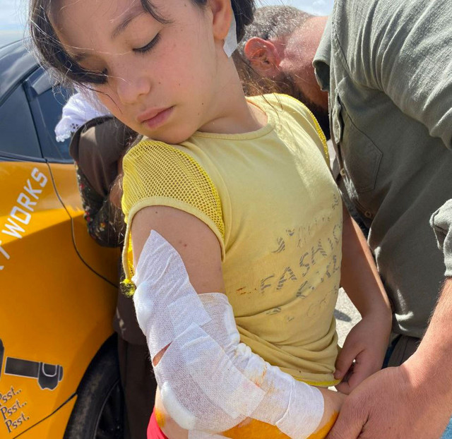 Sivas'ta 9 yaşındaki kız çocuğuna 7 köpek birden saldırdı - Resim: 1