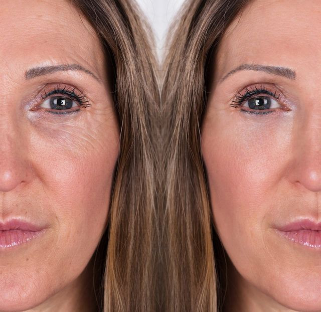 Bu gıdalar genç kalmanızı sağlıyor İşte yaşlanmayı engelleyen besinler - Resim: 2