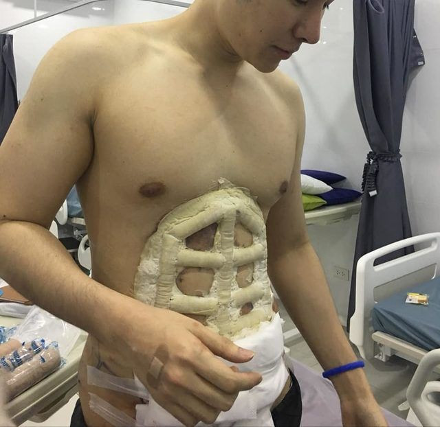 Erkeklerde yeni moda: Ameliyatla baklava yaptırıyor! - Resim: 4