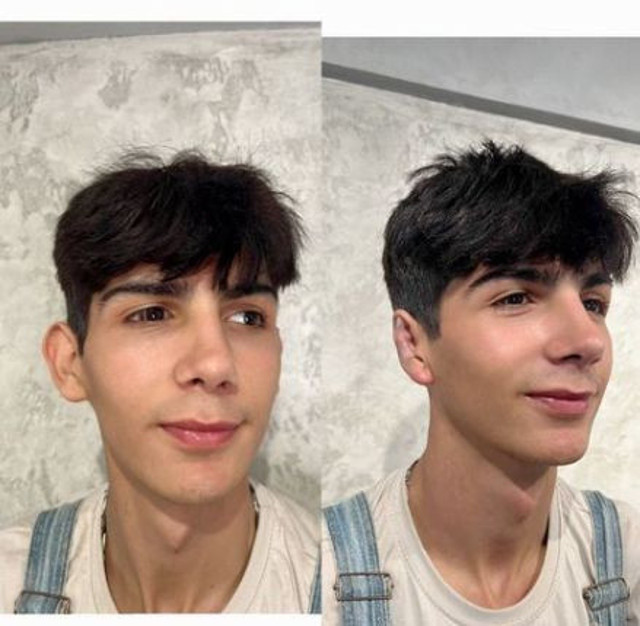 Taha Duymaz'dan çarpıcı itiraflar! Estetik pişmanlığı: Maruz kaldığı zorbalıkları tek tek anlattı! - Resim: 5