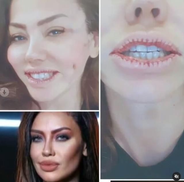 Şarkıcı Lara estetikle herkesin büyültmek istediğini küçülttü son hali bakın nasıl - Resim: 3