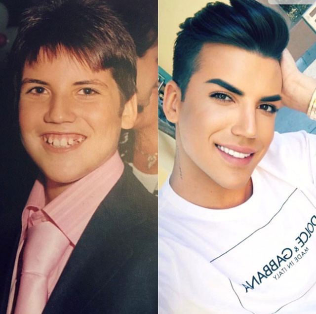 Ata Demirer'den kahkahaya boğan '10 years challange' paylaşımı!  - Resim: 2