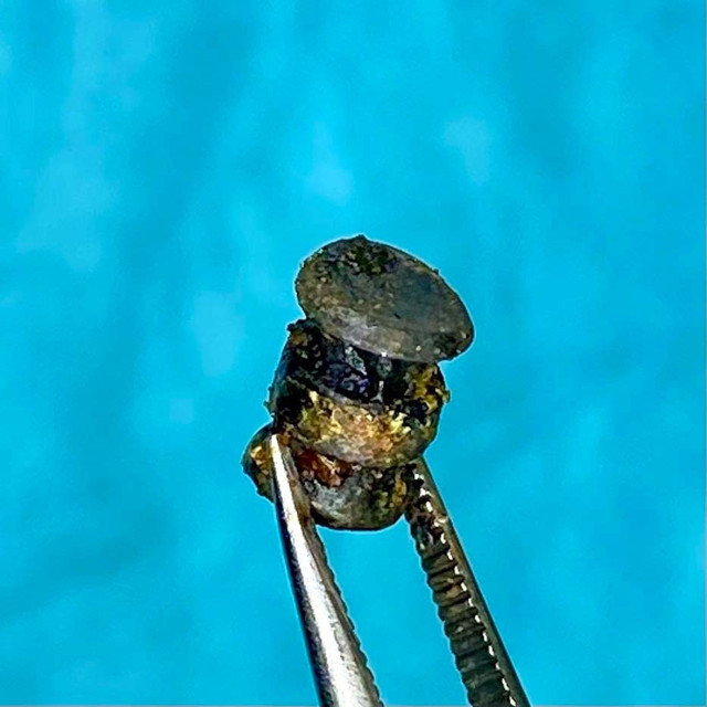 Erzincan'da dişçiye gitti 15 yıl sonra haberdar oldu kurşun büyüklüğündeydi - Resim: 1