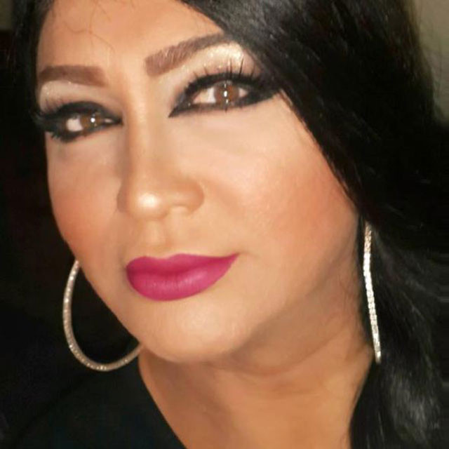 Bir döneme damgasını vuran ünlü şarkıcı Hakan Aslan cinsiyet değiştirdi  - Resim: 2