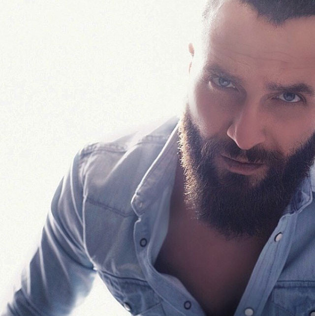 Berkay sahneye çıkabilecek mi? Doktoru Beyaz TV'de açıkladı  - Resim: 3