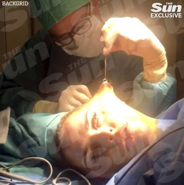 Katie Price yüz germe ameliyatını yayınladı! - Resim: 3